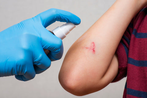 5 Things Every Nurse Should Know About Hypochlorous Acid (HOCl)
