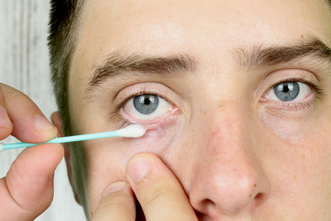 The Mites Among Us: How Demodex Can Impact Your Eye Health