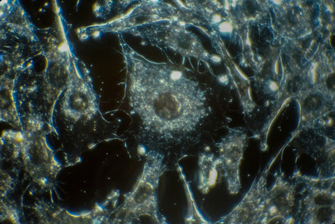 Cytotoxicity: A Word Worth Knowing